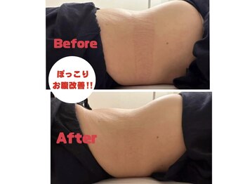 笑うヘソ歌う脳 銀座店の写真/ポッコリお腹をケアして夏を楽しもう!短期集中でスリムなボディを目指す♪寝ているだけでスッキリ!銀座駅