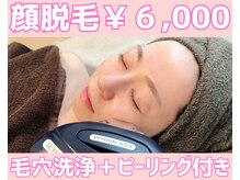 ウィロー
