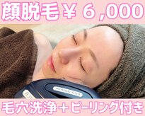 ウィロー