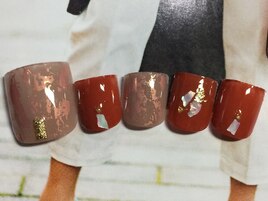 ホイル埋め込みフットネイル