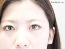 グルス(GRUS)/リフトUPラッシュ