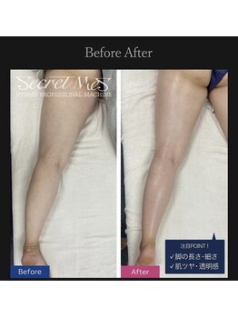 ミィズスタジオ(Mie's Studio)/癒されながら脚すっきりプラン