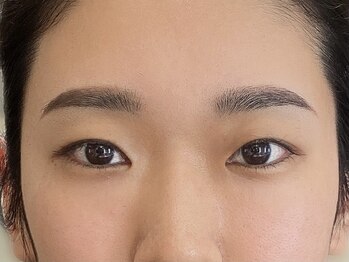 ビューティーガーデン イース/AFTER