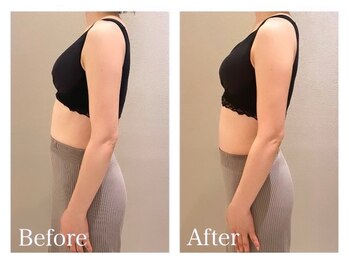 ククナ(KUKUNA)/*バストアップマッサージ*