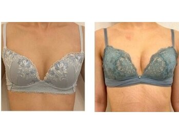 エスビューティー 三軒茶屋(S beauty)/バストケア・池尻大橋・痩身