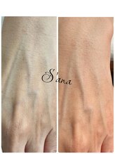 サナ 久が原 千鳥町(S’ana)/ハーブピーリング