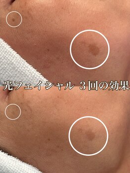 サロン ド マキ(Salon de Maki)/回数を重ねるごとに効果を実感☆