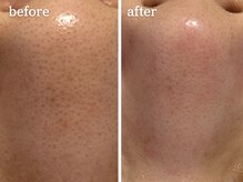 メルシア(merucia)/