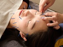 ハマノ鍼灸整骨院の雰囲気（お身体、顔、頭など鍼灸施術もおすすめです）