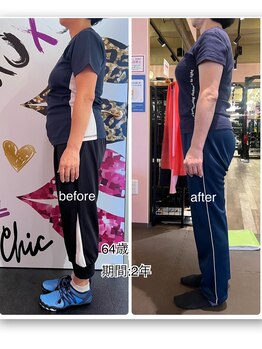 24ダイヤモンドジム(24 DIAMOND GYM)/before/after