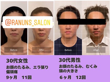 ラナン パラフューズ(Ranun's PARAFUSE.)の写真