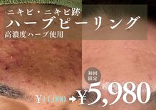 アルト(ALTO)