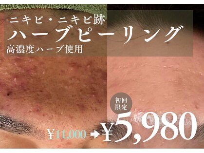 アルト(ALTO)の写真