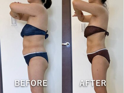 インディバサロン ド メイリィチィフゥア(indibasalon de meiliqihua)の写真