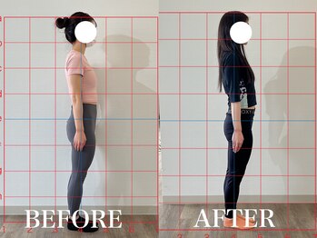 ルア(Lua)/反り腰改善で前もも張り軽減!