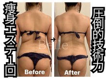 ベル 南船場店(Belle)/痩身エステ1回