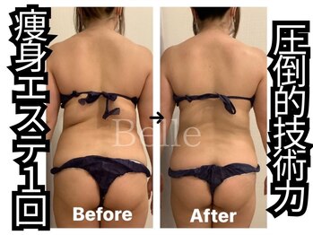 ベル 南船場店(Belle)/痩身エステ1回