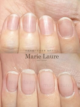 マリーロール 梅田店(Marie Laure)/自爪育成/深爪矯正/ネイルケア