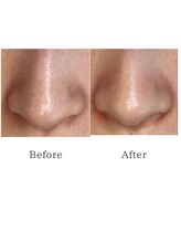 サロン リノ(salon rino)/【メンズにも好評◎ララピール】