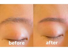トップルック 横浜店(TOP LOOK)/メンズ眉毛ビフォーアフター