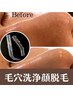 毛穴洗浄プレミア脱毛【脱毛効果UP】ツルツル艶肌へ♪　初回 ¥9800