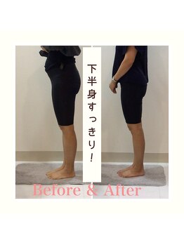 スタイルラボ高松/産後骨盤矯正の効果♪