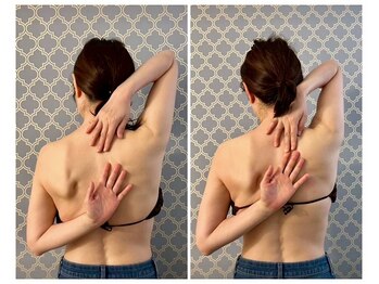 ココア(CoCoa)/肩甲骨洗浄