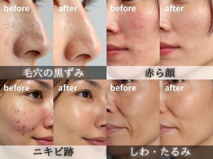 クララエステティック カシハラ(CLALA aesthetic Kashihara)の写真