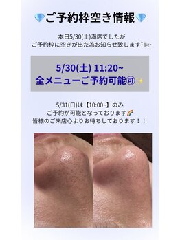 レア(Lea)/週末ご予約枠空きがでました＊