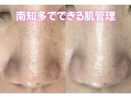 ベベ(bebe)の写真