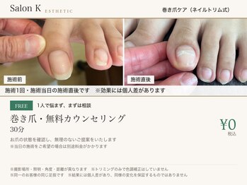 サロン ケー(Salon K)の写真/【歩くのも辛い巻き爪に】国際特許取得ツール×ネイルトリム式の巻き爪ケア