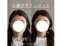 コア 心斎橋 堀江店(koa)/お客様ビフォーアフター