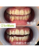 ルブラン 奈良店(Le Blanc)/まずはお試し！