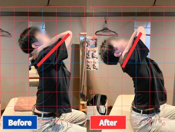 ナオル整体 仙台院(NAORU整体)/猫背が気になって…