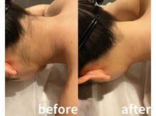サロントット(salon totto)/before→after