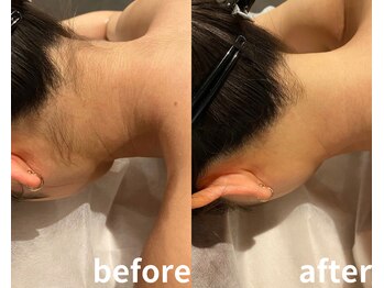 サロントット(salon totto)/before→after