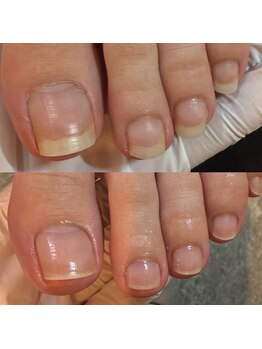 ウェルズユキ(well's yuki)/フットケア専門店/フットケア