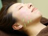 《2回目以降》人気No1◆【美容鍼+部分鍼灸】￥8,200