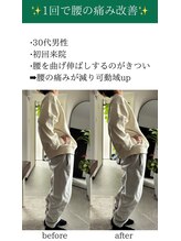 オルカ整体院(ORCA整体院)/【鹿児島/肩こり】