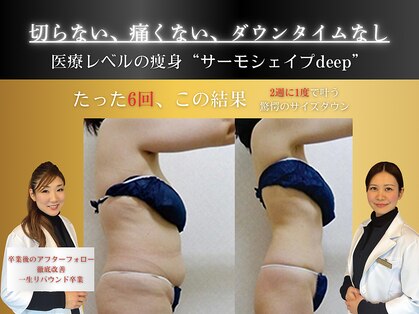 セレブリボーン 大阪ボーテの写真