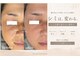 コリー(Kolly)の写真