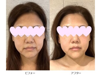 ベルメイク(BELLE MAKE)/美整コルギ☆ビフォーアフター