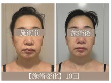 ドクターボディ 恵比寿店(Dr.Body)/【老け顔/たるみ/歪み 50代】