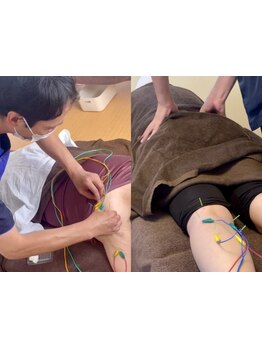 鍼灸施術を受けたい