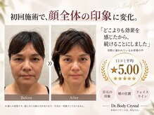 ドクターボディクリスタル(Dr.Body Crystal)