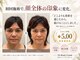ドクターボディクリスタル(Dr.Body Crystal)の写真