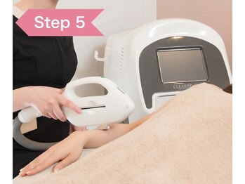 アドラーブル プレ葉ウォーク浜北店/５　実際に光を照射していきます