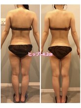 サロン ド フェイス モアナ(Salon de Faith Moana)/キャビテーション痩身