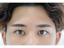 クール(COEUR)/スタンダードコース　施術後