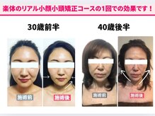 沢山の有名モデルさまや海外のお客さまもご来店の世界が認めたリアル小顔小頭矯正と痩身と美肌サロンです!!